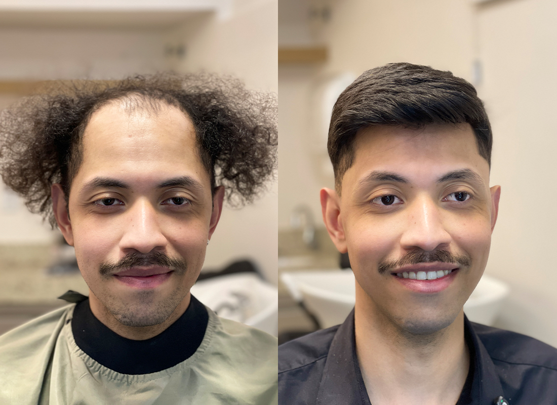 Antes e depois do cliente 3